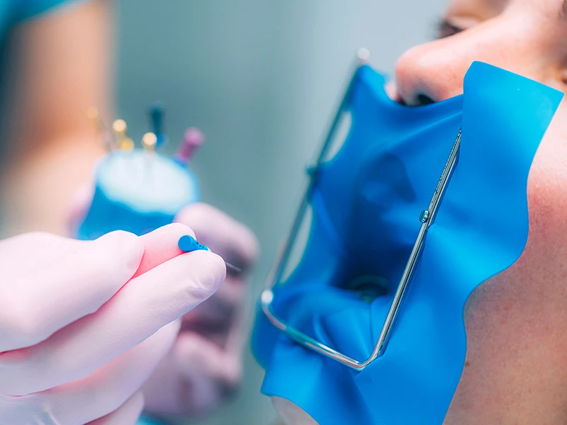 odontologia general endodoncia tratamiento