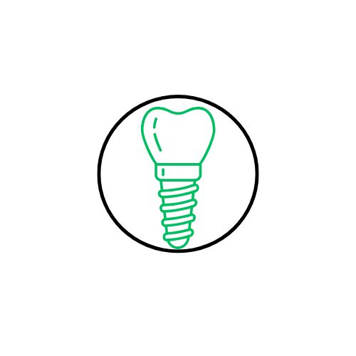 Implantes de Carga Inmediata_Dentista Leganés